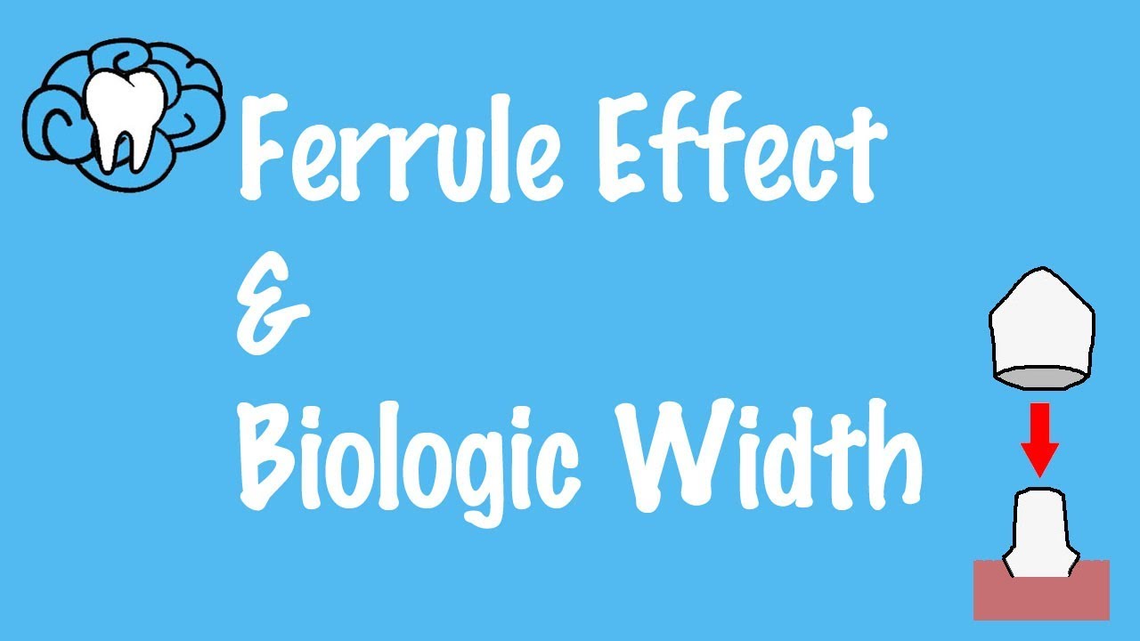 Ferrule Effect and Biologic Width