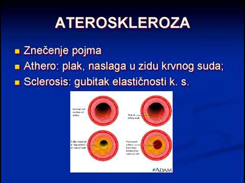 12  Ateroskleroza