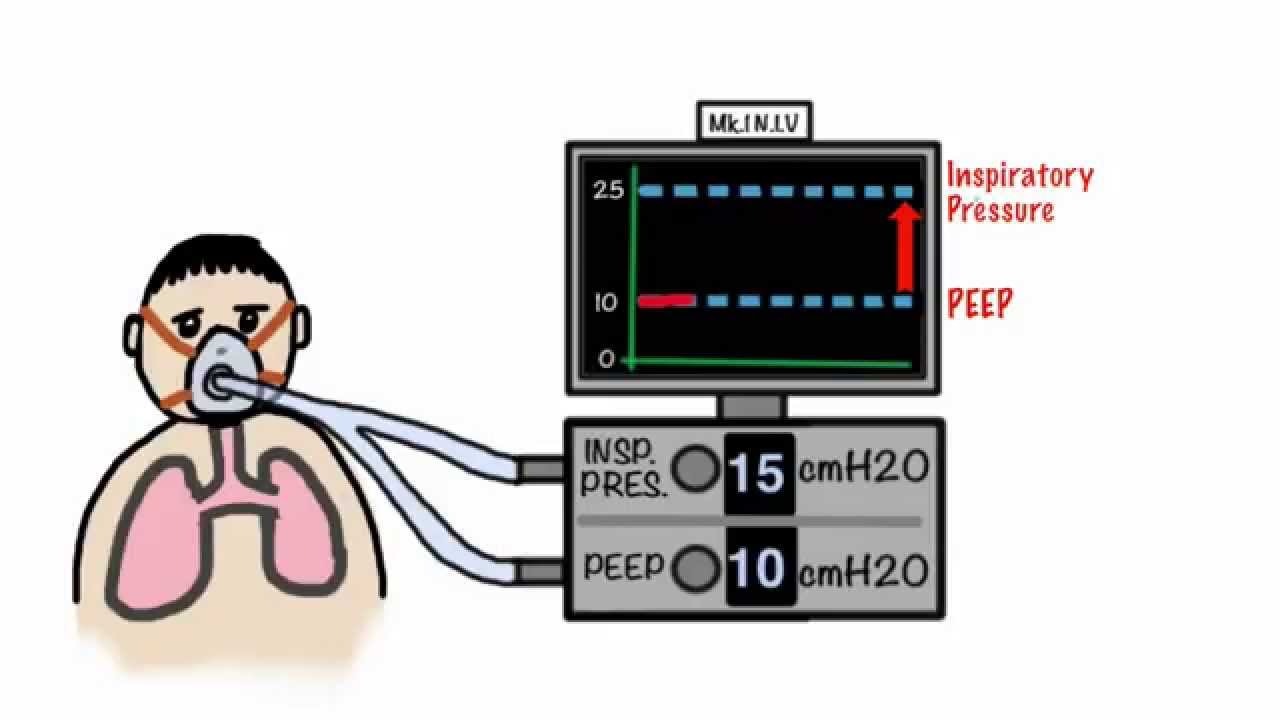 CPAP and Non-Invasive Ventilation in 5 minutes