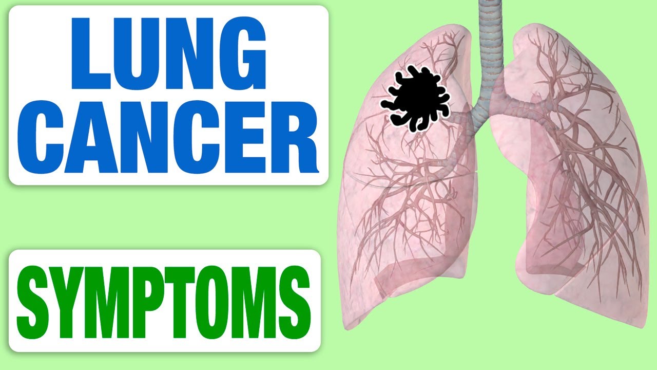 Lung Cancer - All Symptoms