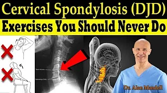 Cervical Spondylosis (DJD) Exercises You Should Never Do (Correct Exercises) - Dr. Alan Mandell, DC